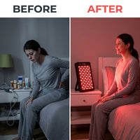 Red Light Therapy, Red near Infrared LED Panel, 72 Quad Chip Flicker Free Leds, Ultra Series, Clinical Grade Device - Popular — Before & After